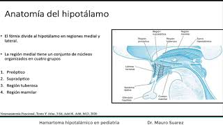 Hamartoma hipotalamico en pediatría [upl. by Nylissej951]