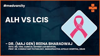 Atypical Lobular Hyperplasia ALH VS Lobular Carcinoma In Situ LCIS  MedvarsityOnlineLtd [upl. by Debor]