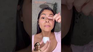 Removed blackheads with egg shorts trending viral ytshots beauty beautips skincare [upl. by Ralston]