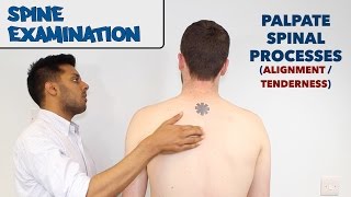 Spine Examination  OSCE Guide old version  UKMLA  CPSA [upl. by Themis]