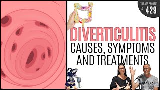 Diverticulitis Causes Symptoms amp Treatments  The ATP Project 429 [upl. by Tesil]