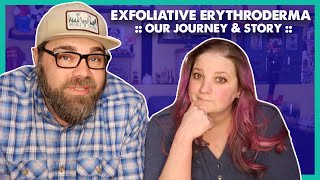 Exfoliative Erythroderma  Our Journey amp Story GRAPHIC IMAGES [upl. by Sofer975]