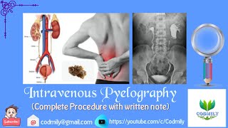 Complete IVP ProcedureIVU [upl. by Nosae]