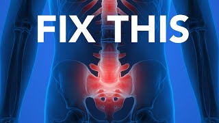 Best Treatment For Osteitis Pubis  Easy Way To Relieve Pubic Bone Pain [upl. by Hurwit]