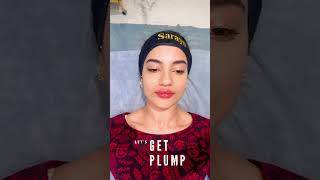 Plump Your Pout  Lip Fillers  Sarayu Clinics filler [upl. by Tiertza462]