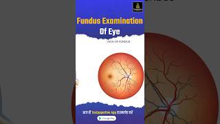 Funds Examination of eye explained simply in less than 60seconds funds examination ophthalmology [upl. by Dionne]