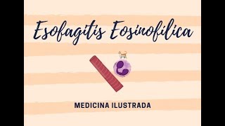 Esofagitis Eosinofílica [upl. by Adlei]