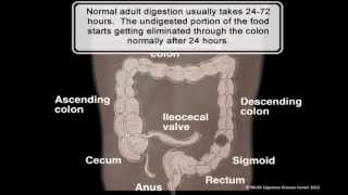 MUSC DIGESTIVE DISEASE CENTER Colonic Inertia [upl. by Tempest]