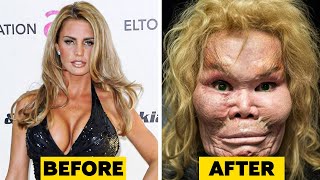 20 Celebrity Plastic Surgery Disasters [upl. by Nnaik]