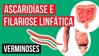 Lombrigas e Elefantíase tipos de verminoses  Resumo de Biologia para o Enem  Cláudia [upl. by Fabi]