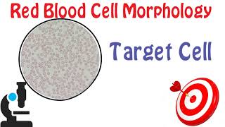 Red Blood Cell Morphology Part 3  Target cell [upl. by Kreitman]