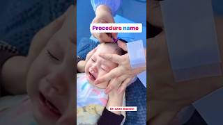 Comment the procedure name  medical procedures  IV injection  blood sample  intubationprocedure [upl. by Fryd701]