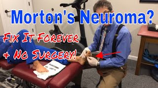 Mortons Neuroma Fix it Forever [upl. by Avek684]