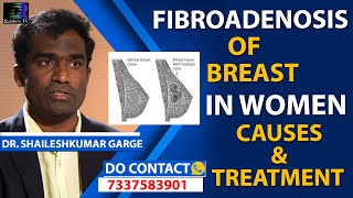 Fibroadenoma of Breast in Women Causes amp New Treatment in Telugu  Citi Vascular Centre [upl. by Shiff]