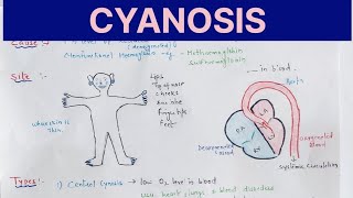 Cyanosis Physiology explained in hindi l Causes l Types l Treatment [upl. by Jack]