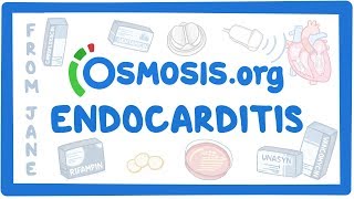 Clinicians Corner Endocarditis [upl. by Jodi3]