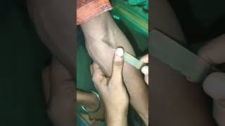 IV injection नस में तेज लगाना सीखेंnursing youtubeshort injection shorts trending [upl. by Estell673]