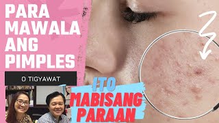 Para Matanggal ang Pimples o Tigyawat Ito Mabisang Paraan  by Doc Katty Go and Doc Willie Ong [upl. by Janeczka]