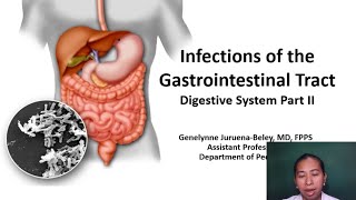 Gastrointestinal Disease in Children 2  Dr Beley [upl. by Iznek242]