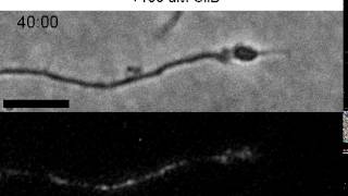 Disruption of dynein slows axonal elongation and induces retraction of the axonal cytoskeleton [upl. by Uyerta720]