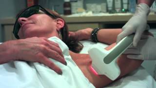 Laser Hair Removal [upl. by Cohlette]