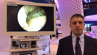 Digital Surgery Solutions DePuy Synthes PUREVUE Visualization System for Imaging in MIS [upl. by Tilney]