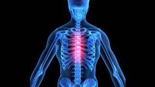 Thoracic Back Pain Explained by a Top Pain Physician in Las Vegas Nevada [upl. by Oletha981]