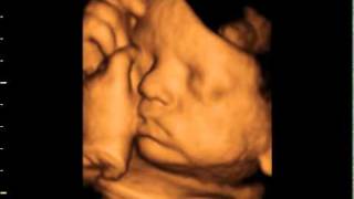 3d 4d ultrasound at 36 weeks GoldenView Ultrasound [upl. by Akimihs]