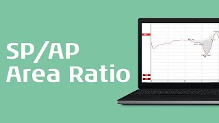 Using the SPAP Area Ratio for Diagnosis of Menieres Disease [upl. by Ariahaj20]