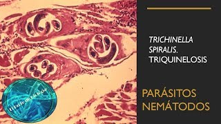 Trichinella Spiralis Triquinelosis Parásitos nemátodos [upl. by Assirol214]