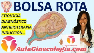 BOLSA ROTA🤰🏽A TÉRMINO DIAGNÓSTICO ANTIBIOTERAPIA MANEJO INDUCCIÓN Ginecología y Obstetricia [upl. by Thrift]