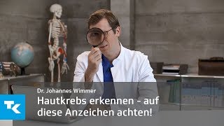 Hautkrebs selbst erkennen  auf diese Anzeichen müsst ihr achten  Dr Johannes Wimmer [upl. by Anilatak199]