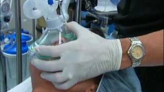 NT About Anesthesia Ch 5  General Anesthesia [upl. by Havener]