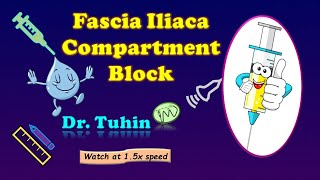 Fascia Iliaca Compartment Block  FICB  Supra Inguinal  Ultrasound  Landmark  LOR  DrTuhinM [upl. by Norri]