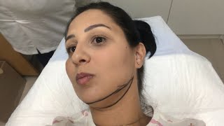 MINHA LIPO DE PAPADA  VLOG PARTE 1 [upl. by Aisatan252]