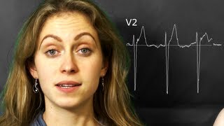 ECG The precordialchest leads V1V6 [upl. by Ahsain]