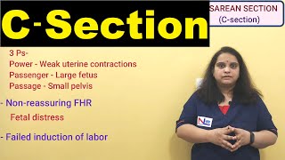 Cesarean delivery  CSection   Nursing Lecture [upl. by Beale]