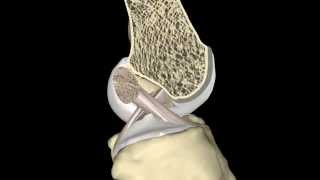 The ACL During Knee Range of Motion [upl. by Eimot361]