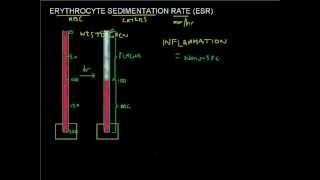 ESR made easy  Erythrocyte Sedimentation Rate  Full Blood Count Masterclass series [upl. by Goldshlag]