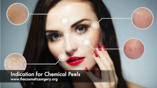 Chemical Peel  Cost Risks Recovery amp Types of Facial Peels at Chennai Plastic Surgery [upl. by Baudoin]