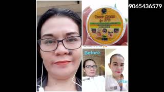 How to use KASOY CREAM by JPD  Proven Effective [upl. by Oecile]