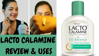 Lacto Calamine Face Lotion Skin Benefitsहिन्दी मैं Calamine lotion Remove Acne Pimples Dark spots [upl. by Mccollum33]