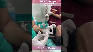 PRP Therapy for hair loss treatment by Dr Vijay Kumar at AWISH clinic [upl. by Zurkow]