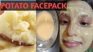 Potato Face pack for skin whitening  7Day challenge  Potato amp Besan Face pack [upl. by Aicilec]