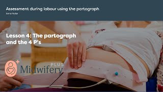 Assessment during labour using the partograph [upl. by Nan]