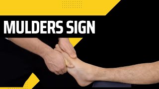 What is the Mulders Click Sign of the foot youtube video [upl. by Lem]