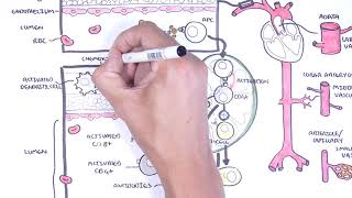 Vasculitis Pathophysiology Overview [upl. by Elleirb636]