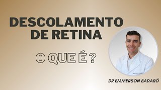 Descolamento de retina  o que é  Quais os sintomas  Dr Emmerson Badaró [upl. by Yraillih]