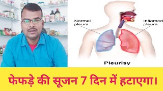 Pleurisyफेफड़े में आई सूजन कम करेगा सिर्फ 7 दिन में। [upl. by Ssew300]