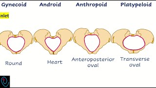 Female pelvic types [upl. by Nowed]